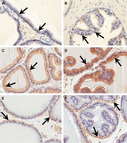 Figure 3 Immunolocalization and immunoexpression of PCNA (A, B), cytokeratin (C, D), and desmin (E, F) in the rat dorsolateral prostate.