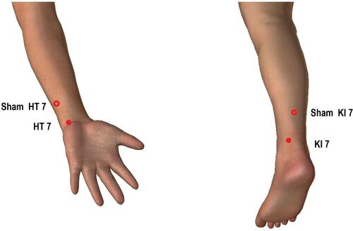 Figure 1 Acupoints for the acupuncture and sham acupuncture groups.