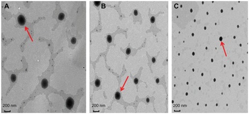 Figure 2 Transmission electron microscopic images of baohuoside I-phospholipid complexes of different sizes. (A) 262 ± 24 nm, (B) 148 ± 12 nm, and (C) 81 ± 10 nm.