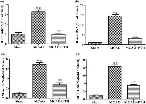 Figure 3. Effects of PTH on cerebral IL-1β (A), IL-6 (B), TNF-α (C), and MCP-1 (D) mRNA levels in MCAO rats (n = 3). Data are presented as mean ± SEM. **p < 0.01 vs. Sham; ##p < 0.01 vs. MCAO.