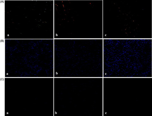 Figure 1. Representative images of (A) picrosirius red-stained, (B) α-smooth muscle actin-stained, and (C) phosphorylated Smad 3-stained slices of kidneys from mice in the (a) sham-operated, (b) vehicle-treated, and (c) alogliptin-treated groups (original magnification in all panels, ×200).