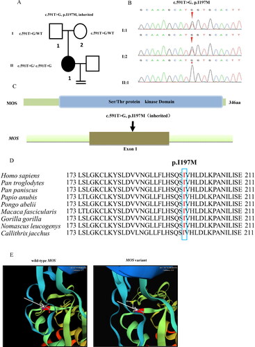 Figure 2. Identification of MOS mutation in the family of the infertile patient. (A) Pedigree of the family. Squares indicate male family members, circles indicate female family members, solid symbol indicates affected members, open symbols indicate unaffected family members, and equal sign denotes no offspring. (B) Sanger sequence analysis in the coding region of MOS in family members is implicated with a homozygous missense mutation. (C) The missense mutation in MOS causes an amino acid substitution of the encoded protein. (D) Conservation analysis of altered amino acids among nine species. (E) MOS variant encoding amino acid disrupted the ion pairs formed by wild-type MOS protein.