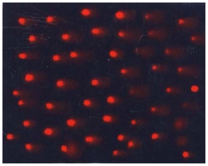 Figure 1 Cells under fluorescent microscope. Image shows cellular effects under 20× fluorescent microscope when stained with ethidium bromide.