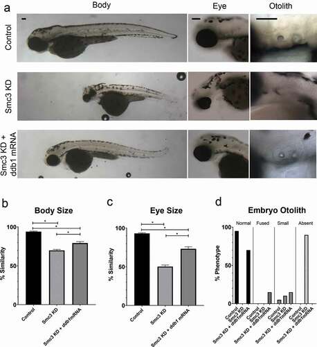 Figure 3. Exogenous ddb1 overexpression rescues Smc3 KD phenotypes. (a) Representative images of control embryos (WT injected with ddb1 mRNA), Smc3 KD (smc3-ATG MO injected) and Smc3 KD + ddb1 mRNA (smc3-ATG MO co-injected with ddb1 mRNA) embryos. For all experiments 26–40 replicates were analyzed and at least 3 independent trials were performed. (b) Quantification of body size from injected embryos were compared to un-injected WT embryos to obtain percent similarity. Bar graph reveals a significant rescue of body length in Smc3 KD + ddb1 mRNA compared to Smc3 KD alone (error bars represent s.e.m., one-way ANOVA with Turkey’s multiple comparison, *P < 0.05). (c) Quantification of eye size from injected embryos were compared to un-injected WT embryos to obtain percent similarity. Bar graph reveals a significant rescue of eye size in Smc3 KD + ddb1 mRNA compared to Smc3 KD alone (error bars represent s.e.m., one-way ANOVA with Turkey’s multiple comparison, *P < 0.05). (d) Graph shows percent of normal, fused, small, or absent otolith phenotypes with MO treatments. Data reveals 0% of Smc3 KD embryos exhibited normal otoliths, while 70% of Smc3 KD + ddb1 mRNA embryo otoliths were rescued to normal levels. A decrease in absent otolith phenotypes was observed with ddb1 mRNA co-injections compared to KD alone. Scale bar: 100 μm.