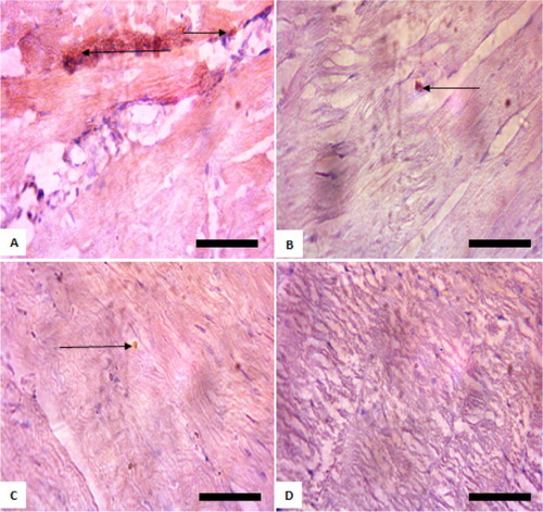 Figure 1. Immunohistochemistry of protein kinase B (PKB) in the heart of rats exposed to sodium arsenite for 4 weeks. (A) Control: shows positive and high expression of PKB; (B) 10 mg/kg NaAsO2: shows lower expression of PKB than control: (C) 20 mg/kg NaAsO2 shows lower expression of PKB than control; (D) 40 mg/kg NaAsO2: shows no expression of PKB. The result is indicative that exposure of rats to NaAsO2 reduced the expressions of survival protein (Akt/PKB). Scale bar (for A, B, C and D) = 5.04 × 3.87 mm. The slides were counterstained with high definition hematoxylin and viewed ×400 objectives.