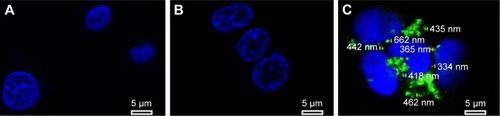 Figure 11 Confocal images of control (A), cells treated with naked FAM-survivin-siRNA (B), and cells treated with NDCONH(CH2)2NH-VDGR/FAM-survivin-siRNA (C).Abbreviation: siRNA, small interfering RNA.