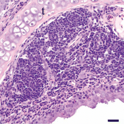 Figure 4.  Nasal concha of a cliff swallow with rhinitis. The lamina propria of the nasal mucosa overlying the turbinate (t) is expanded by a lymphoplasmacytic infiltrate with follicular lymphoid hyperplasia. Note the cluster of cyrptosporidial stages along the surface of the epithelium. Bar = 20 µm. Haematoxylin and eosin.