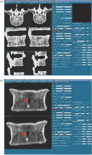 Figure 2. (a) Simultaneous display of two CT volumes (reference [left] and target [right]) in axial, coronal and sagittal views. A single landmark in the L4 verterbra in each volume is shown (blue diamond) on the orthogonal slices that intersect it. Co-homologous points are designated in both volumes and used to bring the L4 in the target volume into spatial alignment with the L4 in the reference volume. For this study, nine landmarks in L4 where used. (b) Close-up coronal view of human vertebra with co-homologous landmarks shown (orange diamonds) in the reference (top) and target (bottom) volumes. [Color version available online.]