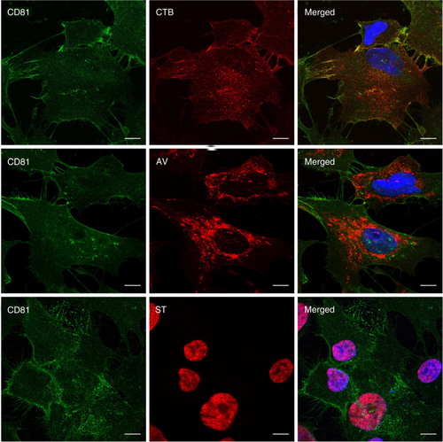 Fig. 6.  Visualization of CTB-, AV- and ST-binding in E1-MYC 16.3 cells. Cells were fixed and co-stained with anti-CD81 antibody (green) and labelled CTB, AV or ST (red). They were then counterstained with Hoechst 33342 to visualize the nuclei (blue). Scale bars, 10 µm.