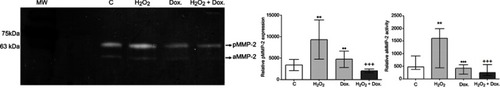 Figure 4 Effects of H2O2 and doxycycline on MMP-2 expression and activity in HSV grafts. MMP-2 expression and activity were determined by gelatin zymography after H2O2 incubation and doxycycline treatment for 16 hrs and were shown by a representative zymogram. **p≤0.01, Control vs H2O2; +++p≤0.001 H2O2 vs H2O2 + Dox; ••p≤0.01, •••p≤0.001 H2O2 vs Dox.; (n=5); Friedman test followed by Conover test. All data are expressed as median and range (min-max).Abbreviations: C, control; Dox., doxycycline; pMMP-2, pro MMP-2; aMMP-2, active MMP-2; MW, molecular weight marker; kDa, kilodalton.