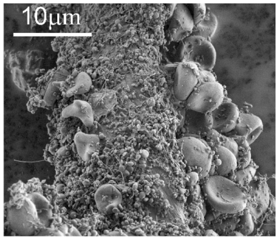 Figure 1 Scanning electron micrograph of an isolate from peripheral blood of a healthy human donor (male, 28 years). A mass of microparticles and numerous residual erythrocytes can be seen. The image was taken using a Quanta TM 250 FEG (FEI, Hillsboro, OR) scanning electron microscope at FEI Quanta, Eindhoven, The Netherlands, by applying 1.5 kV.