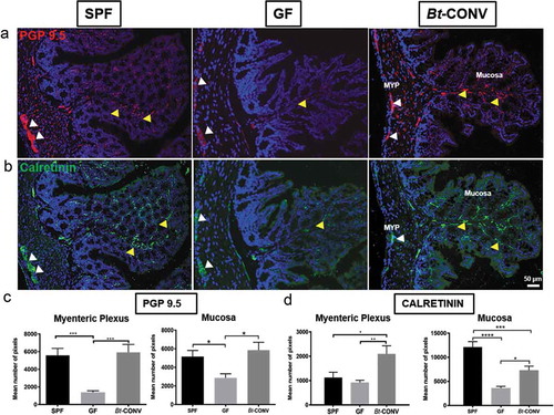 Figure 1. Neuronal innervation is promoted by Bt-CONV.