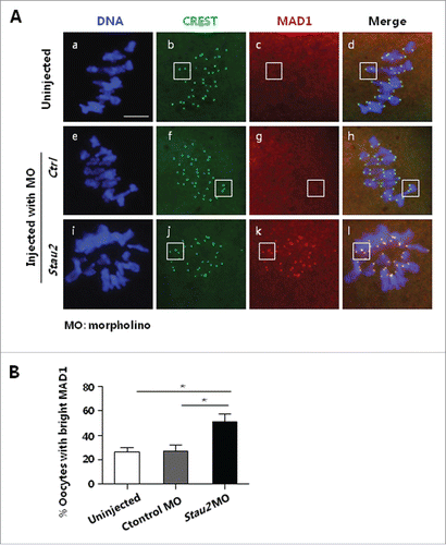 Figure 5. SAC activation in MI oocytes with depleted Stau2 expression. At the end of 8 h maturation culture, MI oocytes were processed for immunostaining with SAC protein MAD1, the proportion of oocytes with weak or no MAD1 signal was statistically analyzed. MAD1 was faintly detected in control oocytes (A, b-d, f-h: boxes), but obviously probed on centromere area in oocytes treated with Stau2 morpholino (A, j-l: boxes).Statistical analysis indicated that the number of oocytes with bright MAD1 was significantly higher in Stau2 morpholino group than that in 2 controls (B). CREST was visualized in green, MAD1 was visualized in red and DNA was labeled in blue. Scale bar = 20 μm.