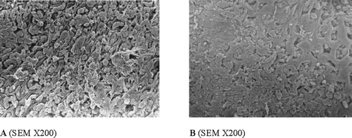 Figure 4 Effect of the ROC (0.4 g kg−1 b.w.; B) on indomethacin-induced gastric ulcers (A) in rats. In the control group, scanning electron micrograph (A) indicates that surface topography was extremely disrupted with epithelial desquamation In the ROC-treated group (B), scanning electron micrograph indicates a normal topography with very slight degree of epithelial degeneration.