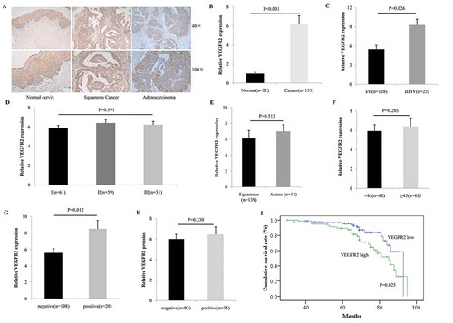 Figure 1. VEGFR2 was overexpressed in cervical cancer and predicted poor prognosis. (a and b) As the IHC showed, positive VEGFR2 staining was detected in 19.1% normal cervix (4/21, none was VEGFR2 high expression) while in 71.5% (108/151, 58 cases were VEGFR2 high expression) cervical cancer (P < 0.001); (c and d) Overexpression of VEGFR2 was not correlated with histological differentiation (P = 0.391), but significantly indicated advanced tumor stage (P = 0.026); (e and f) There was no relationship between VEGFR2 expression and pathological subtype (P = 0.513) or with patient age (P = 0.285); (g and h) Among patients who accepted the surgery (n = 128), high level of VEGFR2 was notably associated with lympho node metastasis (P = 0.012), but not lymph vascular space invasion (P = 0.330); (i) Patients with high expression of VEGFR2 obtained a much shorter overall survival (P = 0.025)