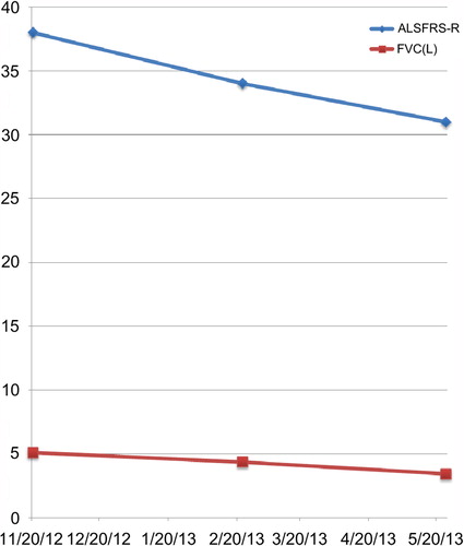 Figure 1. Objective ALS measurements before and after receiving 1100 mg propofol on 14 May 2013.