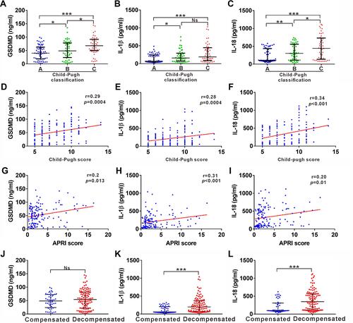 Figure 3 Correlation of serum GSDMD, IL-1ß and IL-18 levels with disease severity in cirrhosis patients. (A-C) ELISA analysis of serum levels of GSDMD (A), IL-1ß (B) and IL-18 (C) in liver cirrhosis patients with Child-Pugh classification A, B and C. (D-F) Correlation between serum GSDMD (D), IL-1ß (E) and IL-18 (F) with Child-Pugh score in liver cirrhosis patients. (G-I) Correlation between serum GSDMD (G), IL-1ß (H) and IL-18 (I) with APRI score in liver cirrhosis. (J-L) Distribution of GSDMD (J), IL-1ß (K) and IL-18 (L) in compensated and decompensated cirrhosis. *p<0.05; **p<0.01; ***p<0.001.