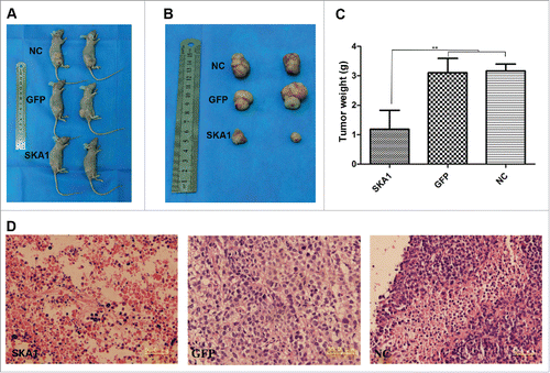 Figure 6. Analysis of SKA1 drug-sensitizing effects using xenograft model. SOSP-9607 osteosarcoma cells stably infected with LV-SKA1-GFP (lower row) or LV-GFP (middle row), or NC cells without infection (upper row) were injected into the right flanks of nude mice, and epirubicin was administered subcutaneously. (A) Representative mice killed at 6 weeks after tumor cell injection, (B) Excised tumors, (C) Average tumor weights from 3 groups, and (D) Hematoxylin and eosin staining of dissected tumor tissues from the 3 groups (SKA1, left; GFP, middle; NC, right). Among these, the SKA1 group (left panel) showed more necrosis. Bar, 50 µM, Magnification, ×400. *P < 0.05, **P < 0.01, ***P < 0.001.