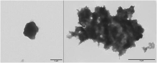 Figure 4. TEM images of a solitary ACC (left) and bulky adducts prepared from ZnCO3 templates. The longest diameter of the solitary ACC measures about 1 μm, while the adduct measures 13.2 μm.
