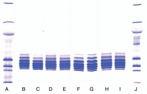 Figure 1 Comparison of the isoforms of different lots of IgG1 product produced using Process 1 and 2. (A and J) Markers; (B) Process 1, Lot 1; (C) Process 1, Lot 2; (D) Process 2, Lot 1; (E) Process 2, Lot 2; (F) Lot 1, Location 1; (G) Lot 2, Location 2; (H) Lot 3, Location 1; (I) Lot 4, Location 2.