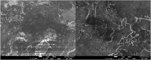 Figure 4. (a), (b). Scanning electron microscopic image showing biofilm of S. epidermidis.