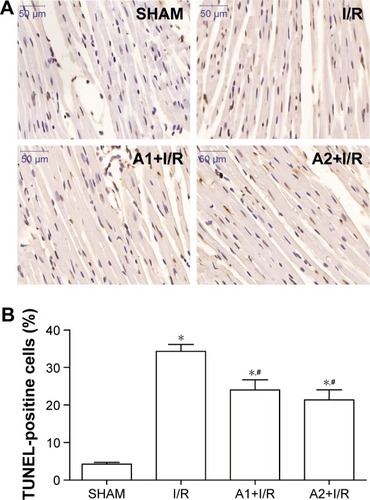 Figure 5 Effect of AOS pretreatment on myocardial apoptosis 3 hours after I/R injury as determined by TUNEL staining.