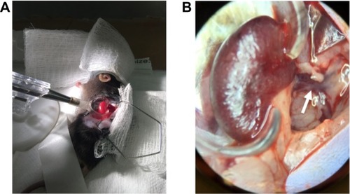 Figure 1 Set-up before measurement. (A) Mouse is placed in right lateral decubitus and the kidney is externalized and placed in a kidney cup. (B) Ventral face of left kidney and left renal artery (white arrow), which divides in two and travels above the renal vein.