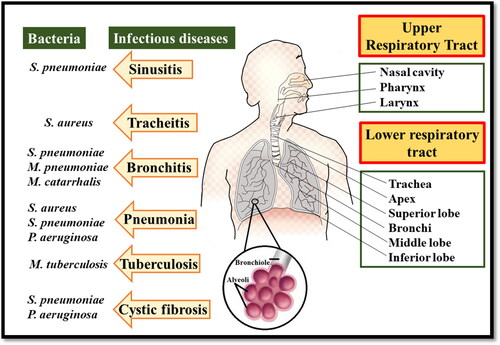 Figure 1. Anatomy of the respiratory tract and its bacterial infection.