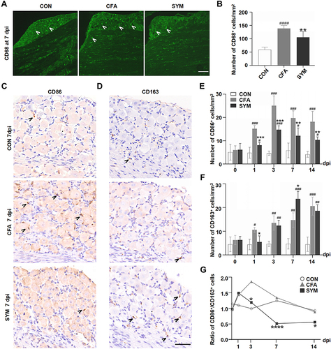 Figure 2 Change of macrophages in sympathetic-deprived trigeminal ganglia after CFA inflammation over time. Immunofluorescence staining of CD68 shows the distribution of all activated macrophages in the maxillary nerve region of the TG at 7 dpi, Cells stained with CD68 are indicated by arrowheads. Scale bar represents 100 μm. (A) The number of CD68-positive cells in the TG from the control, CFA and SYM group, n = 4 per group (B). Immunostaining for CD86-positive cells (C) and CD163-positive cells in the TG at day 7 after the induction of inflammation. Cells stained with CD86 or CD163 are indicated by arrowheads. Scale bar represents 40 μm (D). The time course of changes in the number of CD86-positive cells (E) and CD163-positive cells among 3 groups; n = 4 per time point. (F) The ratios of M1 (CD86) to M2 (CD163) in the TG during CFA-induced orofacial pain in mice at different time points (G). P < 0.05 (*), 0.01 (**), 0.001 (***), 0.0001 (****) compared with CFA group; P < 0.05 (#), 0.01 (##), 0.001 (###), 0.0001 (####) compared with control group using one-way ANOVA with Dunnett t’s post hoc test. Ratios were compared using the Chi squared test.