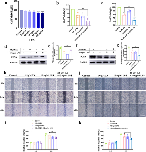 Figure 1 Inflammation exacerbated the inhibition of HOK proliferation and migration with oncologic dose of ZA treatment, but did not aggravate this with the osteoporosis therapeutic dose of ZA treatment. (a) Cell viability of HOK treated with gradient concentration LPS for 48 hours. (b) Effect of the osteoporosis therapeutic dose of ZA (2.5 μM) and LPS (10 ng/mL) on HOK cell viability for 48 hours. (c) Effects of the oncologic dose of ZA (10 μM) and LPS on HOK cell viability for 48 hours. (d) Representative Western blot of PCNA. (e) Western blot analysis. (f) Western blot analysis of PCNA. (g) Quantification of Western blot results. (h) Wound healing assays in HOK cells were simulated with 2.5 μM ZA or/and 10 ng/mL LPS at 24, and 48 hours. Scale bar, 500 μm. (i) The analysis of wound healing assay. (j) Wound healing assays in HOK cells were simulated with 10 μM ZA or/and 10 ng/mL LPS at 0, 24, and 48 hours. Scale bar, 500 μm. (k) The analysis of the wound-healing assay. Data were given as the mean±SD. *P < 0.05. **P < 0.01. ***P < 0.001. ****P < 0.0001.