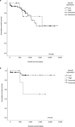 Figure 4 (A) Correlation of Smurf2 expression and overall survival of the entire patient cohort revealed no significant difference between Smurf2 high and Smurf2 low tumors (n=98) (P=0.86). (B) Correlation of Smurf2 with microsatellite status and overall survival. Overall survival was significantly impaired in microsatellite stable (MSS) patients expressing high levels of Smurf2 (n=58) (*P=0.044).