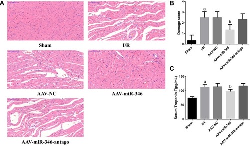 Figure 5 Over-expression of miR-346 attenuates histopathological changes and myocardial damage. (A) HE detection of Sham, I/R, AAV-NC, AAV-miR-346 and AAV-miR-346-antago groups (x200). (B) Myocardial injury scores. (C) Serum myocardial injury marker cTnT levels. Note that aP < 0.05 against the Sham group. bP < 0.05 against the I/R or AAV-NC group.