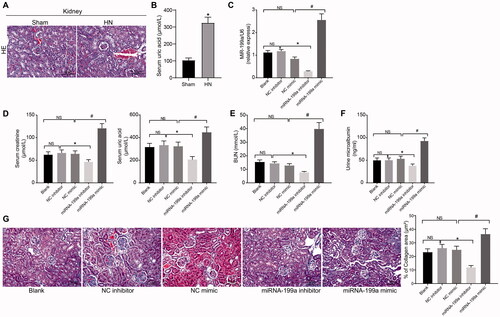 Figure 1. miR-199a is upregulated in hyperuricemia and induces renal injury. (A) HE staining (×400, scale bar = 50 um). (B) Biochemical analysis of UA in rat serum. (C) miR-199a expression tested by RT-qPCR. (D–F) SCr and UA (D), BUN (E), and mALB (F) contents were determined by biochemical analysis. (G) The degree of renal fibrosis was examined using Masson's staining (200×). NS means not significant. N = 5. *p < 0.05 vs. NC inhibitor group; #p < 0.05 vs. NC mimic group; Results of each group were measured data expressed as mean ± SD. One-way AVONA was used for comparison among groups.