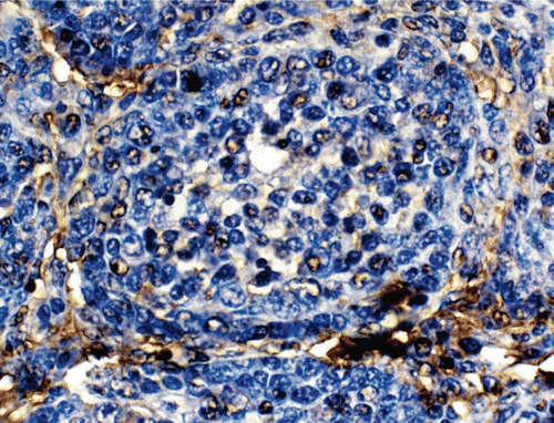 Figure 3.  Photomicrograph of bursa of Fabricius from representative progeny chick of a Group G hen fed OTA-contaminated feed at 10 mg OTA/kg feed for 21 days. The relatively few IgA-bearing cells (DAB stained) present here are indicated by arrow heads (DAB & Hematoxylin stain; 600× magnification).