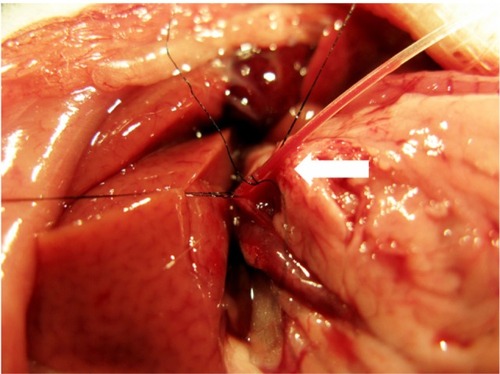 Figure 1 Catheterization and transcatheter arterial embolization were performed in a rat model. A silastic tube was inserted retrograde into the gastroduodenal artery (straight arrow), and iodized oil or saline was slowly injected.