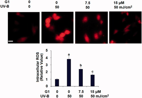 Figure 3. Treatment with the specific GPR30 agonist G1 ameliorates UV-B radiation-induced oxidative stress in ESCs. ESCs were stimulated with ultraviolet-B (UV-B) (50 mJ/cm2) with or without 7.5, 15 μM G1 for 24 h. Intracellular ROS was determined by dihydroethidium (DHE) staining. Scale bar, 50 μm (a, b, c, p < .01 vs. previous group, n = 5–6).