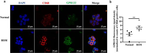 Figure 5. Increased expression of GPR133 was found in decidual macrophages from RSM patients. (a) The expression of GPR133 was examined in decidual macrophages from normal subjects (top row) and RSM patients (bottom row) using immunofluorescence microscopy. Scale bar = 25 μm. (b) Quantification of the fluorescence signal for GPR133 was performed using ImageJ. The mean integrated density of each field was normalized to the number of CD68-positive cells in the field. The statistical data are presented as the means ± SEMs and were analysed by two-sided unpaired Student’s t tests. **p < 0.01.