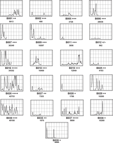 Figure 3 Examples of CD3 (Leu4) immunostaining in 21 separate breast tumors showing plots. [x and y axes are standardized and are the same as indicated in Figure 2].