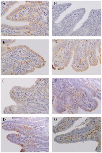 Figure 4. Immunohistochemistry of claudin-1 in distal jejunum of piglets (×400). Group A was control group and piglets in this group were fed with basal diet; Piglets in groups B, C and D were fed with basal diet + (500, 2000 and 5000 mg/kg·BW) β-conglycinin, respectively; Piglets in groups E, F and G were fed with basal diet + (500, 2000 and 5000 mg/kg·BW) glycinin, respectively; Group H was negative control. The average optical density (OD) value of claudin-1 expression was analysed by the Image-Pro plus 6.0 and as shown in Table 7.