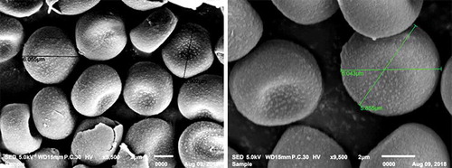 Fig. 3 Ustilago cynodontis teliospores (5.85 to 6.055 µm) under a scanning electron microscope, bar = 2 µm