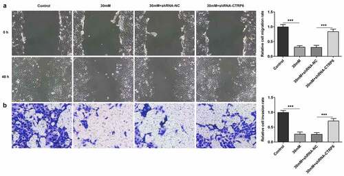 Figure 3. The ability of cell migration and invasion was assessed using (a) wound healing and (b) Transwell assay, magnification, x100. ***P < 0.001.