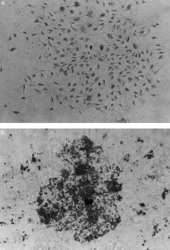 Figure 4. The von Kossa staining of the cells on conventional dish (A) and collagen‐coated dish (B) after 2 weeks culture.
