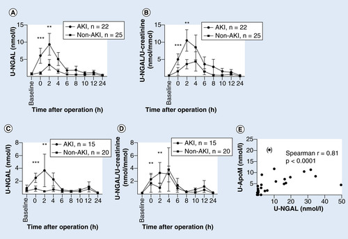 Figure 4. Urinary NGAL and urinary NGAL/creatinine ratio in children undergoing cardiac surgery.A baseline urine sample was taken before the operation, and postoperative sampling was done every 2 h for the first 12 h and then at 24 h. Patients were assigned to two groups–acute kidney injury (AKI) or no kidney affection (non-AKI) according to the KDIGO classification of AKI. An outlier (patient no. 35) has been omitted. Patients with hemoglobinuria were excluded in C + D. Points represent mean ± SEM. (A) U-NGAL (nmol/l), *p < 0.0001, **p = 0.0059. (B) U-NGAL/U-creatinine ratio (nmol/mmol), *p = 0.0005, **p = 0.0052. (C) U-NGAL (nmol/l), *p = 0.0009, **p = 0.0048. (D) U-NGAL/U-creatinine ratio (nmol/mmol), *p = 0.0027. **p = 0.0059. (E) Correlation between 2 h U-apoM and U-NGAL measurements. Spearman r = 0.8052 (p < 0.0001). Pt no. 35 has been omitted from the regression analysis (included in parenthesis).
