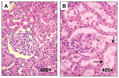 Figure 1 Histological sections from control and experimental rats. (A) Control rats, (B) sStx2-treated rats showing mesangiolysis (black asterisk) and tubular necrosis (black arrow).