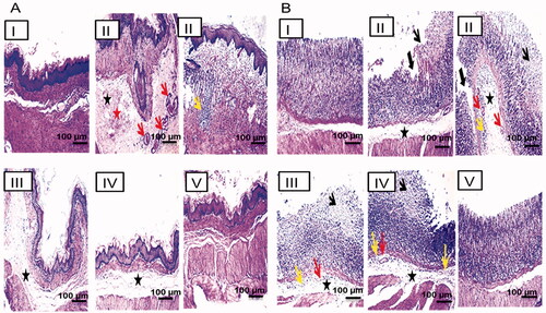 Figure 7. Histopathological examination (hematoxylin and eosin stained, 100x) of the gastric tissue of (A) the non-glandular and (B) the glandular gastric mucosa. I, II, III, IV, and V are as under Figure 6. Submucosal edema (black asterisk), congestion (red arrow), hemorrhage (red asterisk), leukocytic cells infiltration (yellow arrow), mucosal necrosis (thin black arrow), and ulceration (thick black arrow).