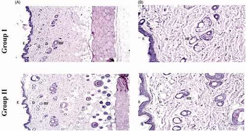Figure 4. Photomicrographs showing histopathological sections (hematoxylin and eosin stained) of rat’s skin normal control (group I) and rat’s skin treated with PC6 (group II) with magnification power of 16x to illustrate all skin layers (A) and magnification power of 40x to identify the epidermis and dermis (B). E: epidermis; D: dermis; HF: hair follicles; FTN: fenticonazole nitrate; PC: PEGylated cerosomes.