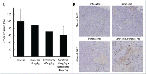 Figure 6. Synergistic inhibitory effect of sorafenib and deferasirox against HCC in vivo (A) HepG2 cells (3×107 per animal) were implanted subcutaneously into the right flank of mice. Sorafenib and/or deferasirox administration was initiated one week after injection. Each agent was orally administered daily for 5 d per week. Tumor measurement was started 3 weeks after injection. (B) Resected tumors were analyzed for cleaved PARP by immunohistological staining. Cleaved PARP staining showed apoptotic cells as positive spot areas.