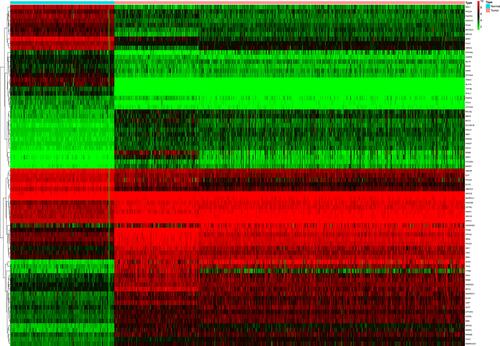 Figure 1 A heatmap of 75 differential DDR-related genes.