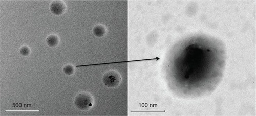 Figure 8 Transmission electron microscopy micrographs of poly(β-amino ester)-g-poly(ethylene glycol) methyl ether-cholesterol micelles (pH=7.4).Note: The right image is the magnified result of the left image.