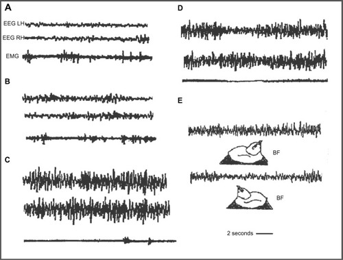 Figure 4 Electrographic recordings in the domestic chick during sleep.